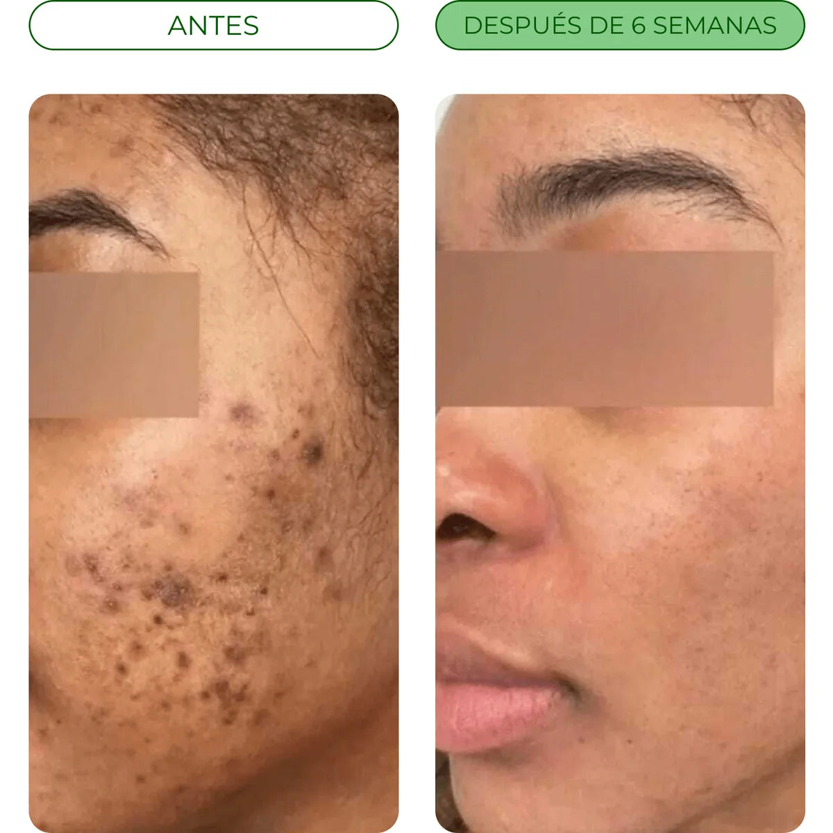 Antes y después de 6 semanas