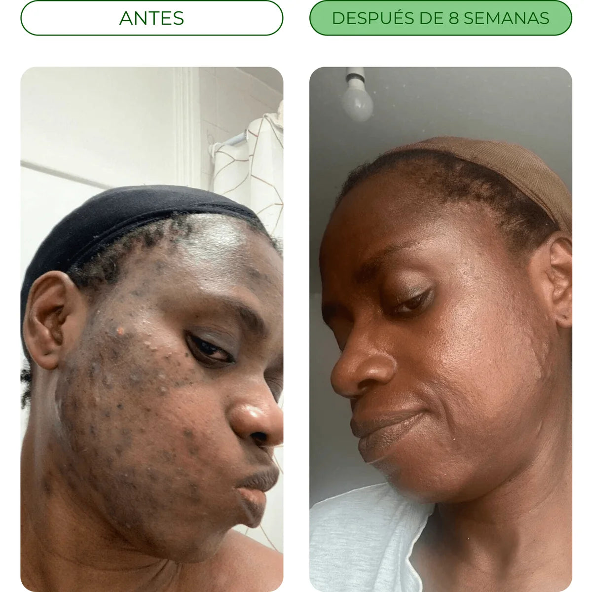 Antes y después de 8 semanas