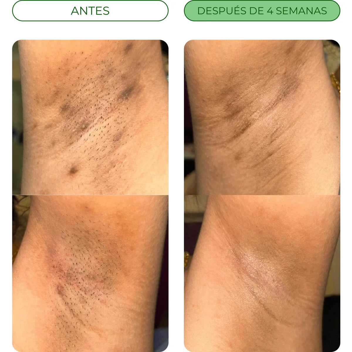 Antes y después de 4 semanas